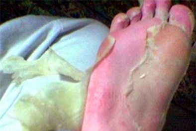 Thực hư mặt nạ da chân chứa độc chất 